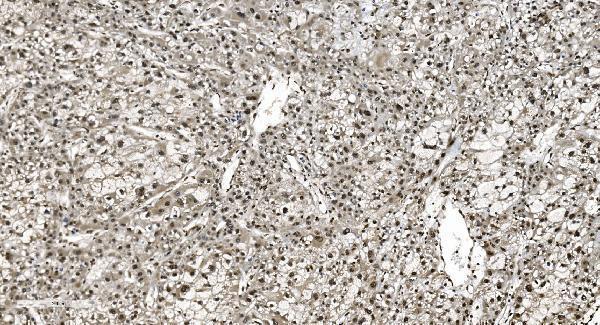 a11090 1 hnrnpn3 primary antibodies ihc testing 4