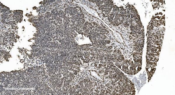 a11090 1 hnrnpn3 primary antibodies ihc testing 5