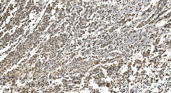 a11090 1 hnrnpn3 primary antibodies ihc testing 6