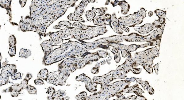 a11090 1 hnrnpn3 primary antibodies ihc testing 7