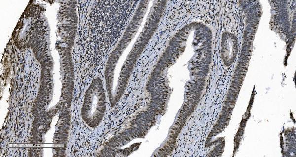 a11090 1 hnrnpn3 primary antibodies ihc testing 8