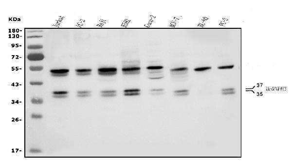  Western blot analysis of HNRNPH3 using anti-HNRNPH3 antibody (A11090-1)