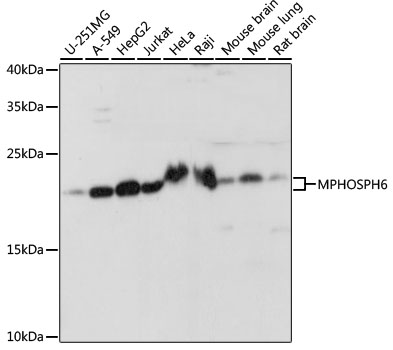 Western blot analysis of extracts of various cell lines, using MPHOSPH6 antibody  at 1:1000 dilution