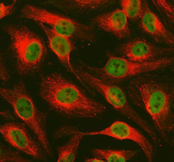a11092 2 prdm11 primary antibodies if testing 1