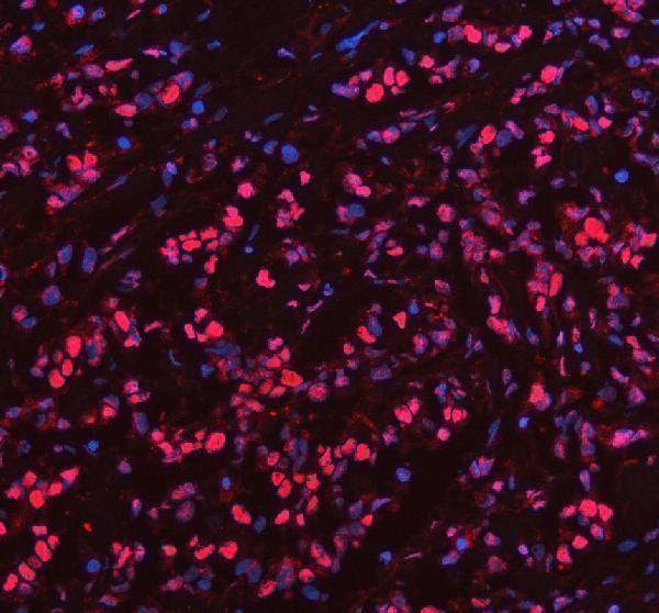 a11092 2 prdm11 primary antibodies if testing 2_1