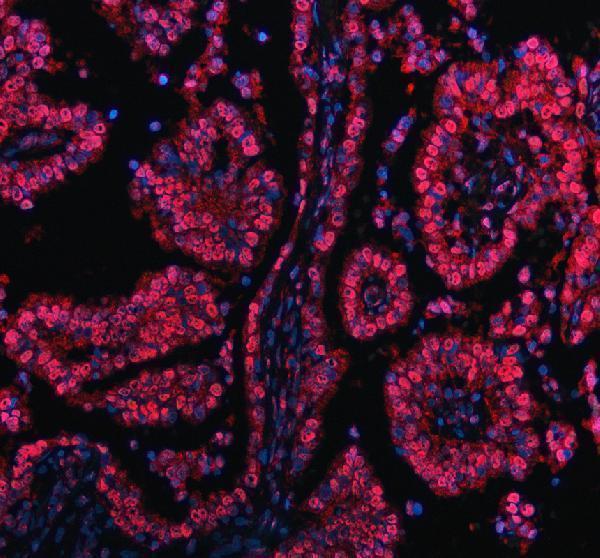 a11092 2 prdm11 primary antibodies if testing 3