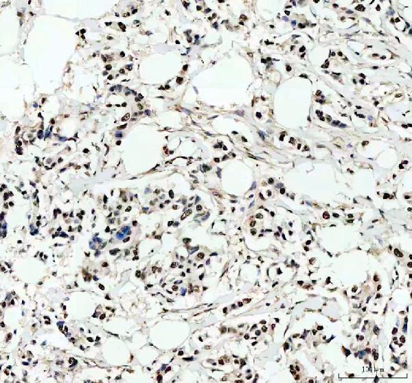 IHC analysis of PRDM11 using anti-PRDM11 antibody (A11092-2)