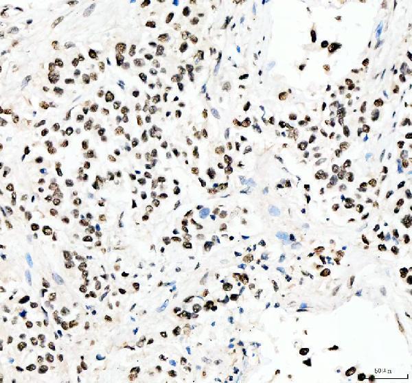 IHC analysis of PRDM11 using anti-PRDM11 antibody (A11092-2)