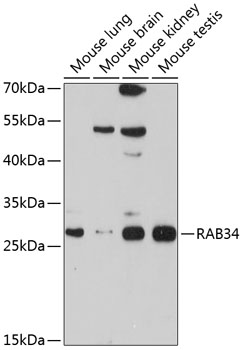 Western blot analysis of extracts of various cell lines, using RAB34 antibody  at 1:1000 dilution