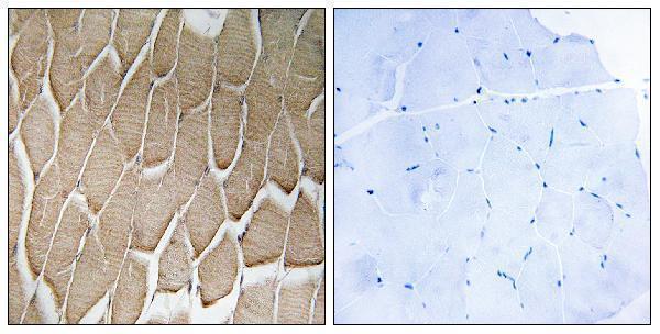 Immunohistochemistry analysis of paraffin-embedded human skeletal muscle, using RAB34 Antibody