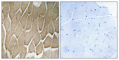 Immunohistochemical analysis of paraffin-embedded Human skeletal muscle