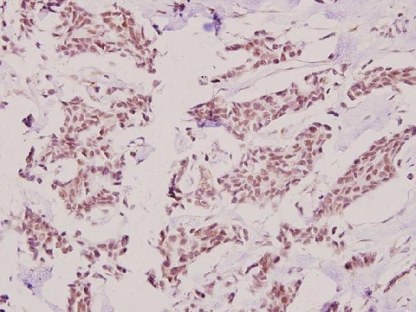 a11100 1 hkr1 primary antiboties ihc testing 2