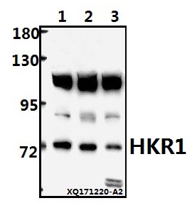 a11100 1 hkr1 primary antiboties wb testing 1