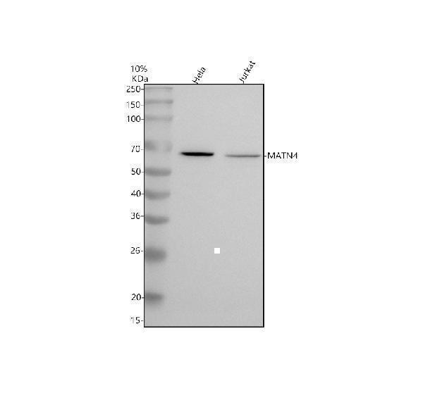 a11103 1 matrilin 4 matn4 primary antibodies wb testing 1