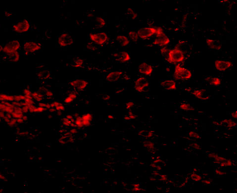 Immunofluorescence of MATN4 in mouse brain tissue with MATN4 antibody at 20 μg/mL