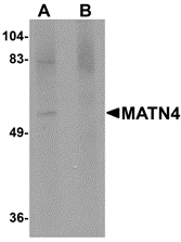Western blot analysis of MATN4 in rat brain tissue lysate with MATN4 antibody at 1 μg/mL in (A) the absence and (B) the presence of blocking peptide