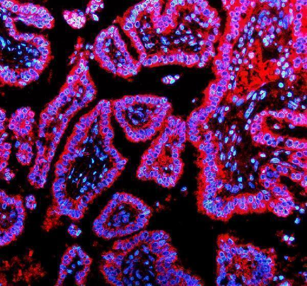 a11104 timm9 primary antibodies if testing 1