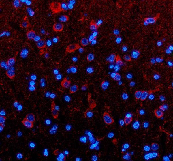 a11104 timm9 primary antibodies if testing 2