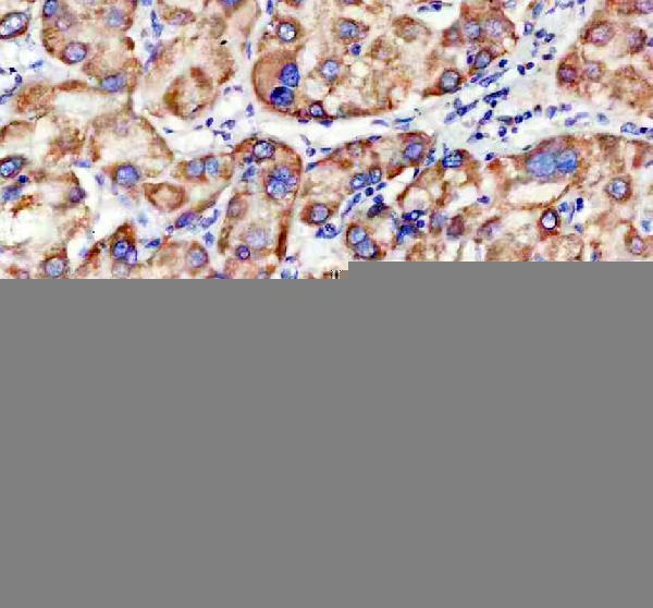 a11104 timm9 primary antibodies ihc testing 1