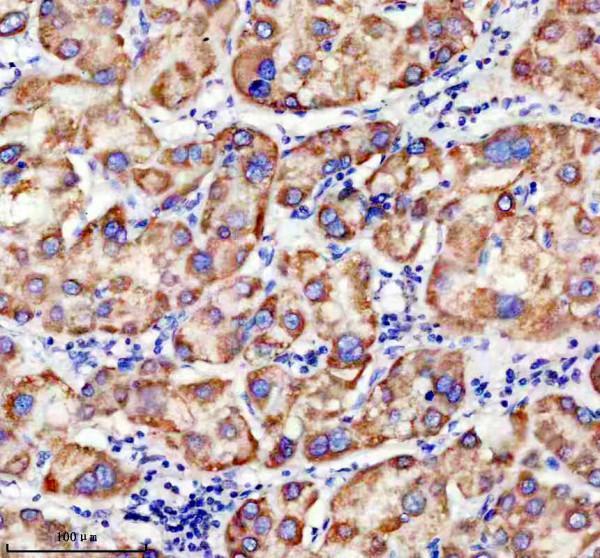 a11104 timm9 primary antibodies ihc testing 1_1