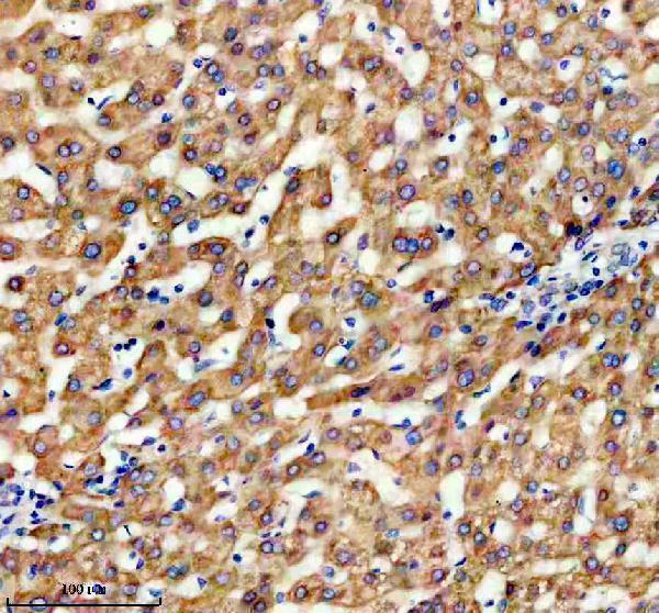 a11104 timm9 primary antibodies ihc testing 2