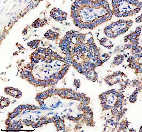 a11104 timm9 primary antibodies ihc testing 3