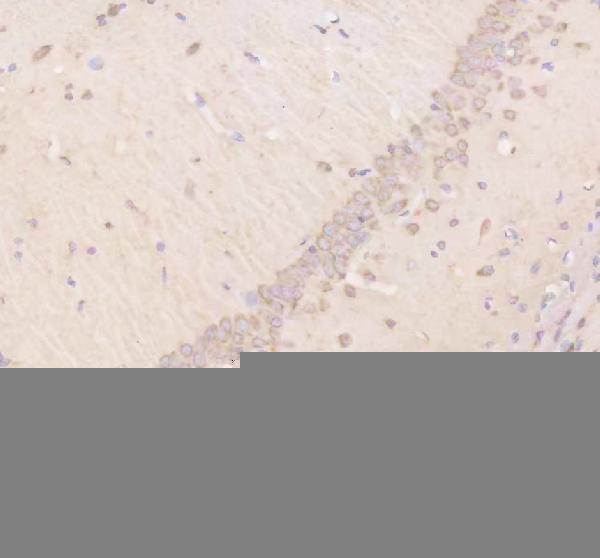 a11104 timm9 primary antibodies ihc testing 4