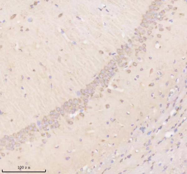 a11104 timm9 primary antibodies ihc testing 4_1