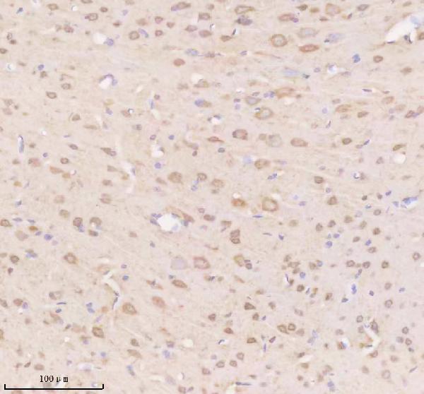 a11104 timm9 primary antibodies ihc testing 5