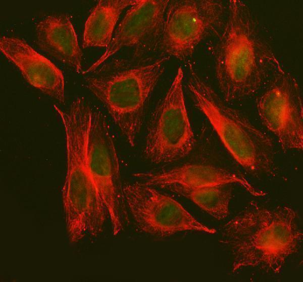  IF analysis of NOL9 using anti-NOL9 antibody (A11105-1) and anti-Beta Tubulin antibody (M01857-3)