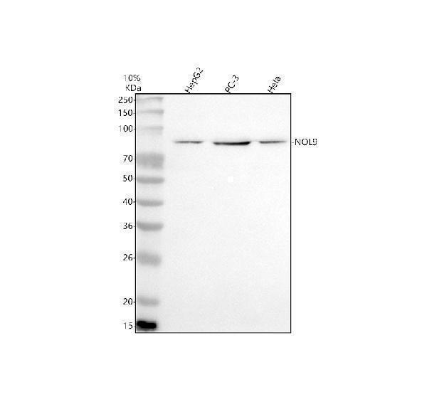  Western blot analysis of NOL9 using anti-NOL9 antibody (A11105-1)