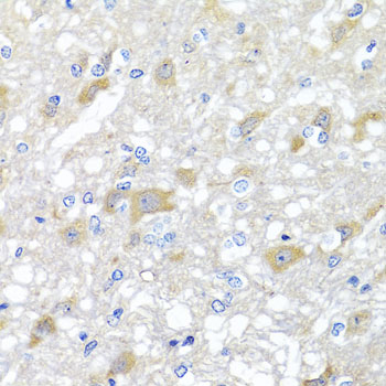 Immunofluorescence analysis of A-549 cells using INPP5K Rabbit pAb  at dilution of 1:150 