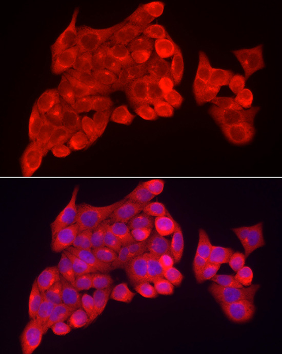 Immunofluorescence analysis of HeLa cells using INPP5K Rabbit pAb  at dilution of 1:150 