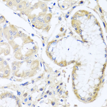 a11107 inpp5k primary antiboties wb testing 2