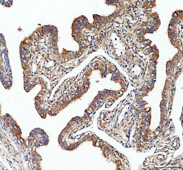 a11108 1 arpc1a primary antibodies ihc testing 1