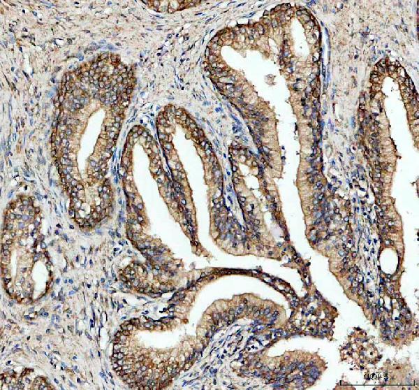 a11108 1 arpc1a primary antibodies ihc testing 2