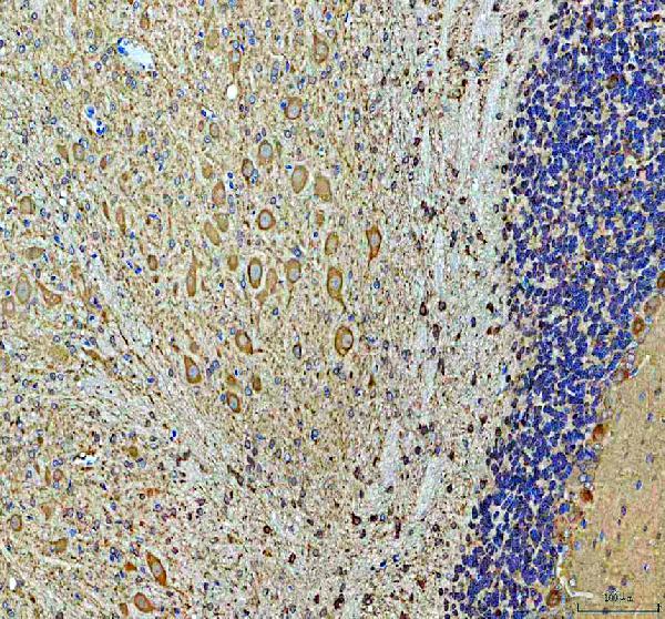 a11108 1 arpc1a primary antibodies ihc testing 4