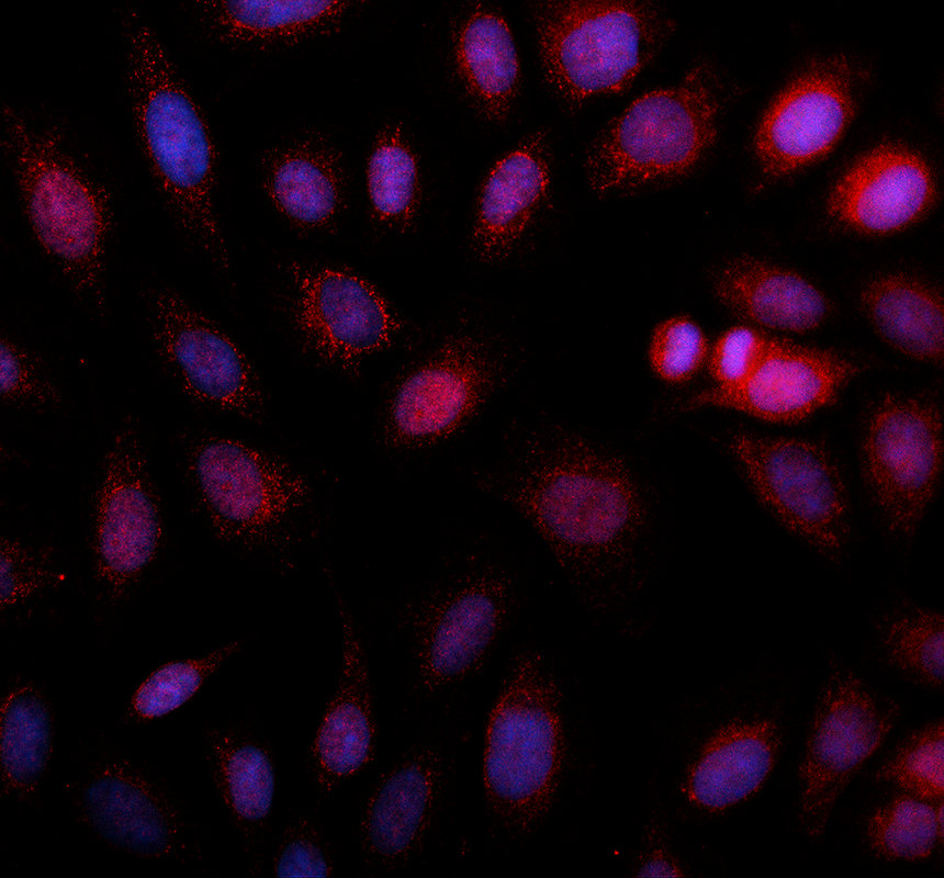 IF analysis of MTFMT using anti-MTFMT antibody (A11112-1)