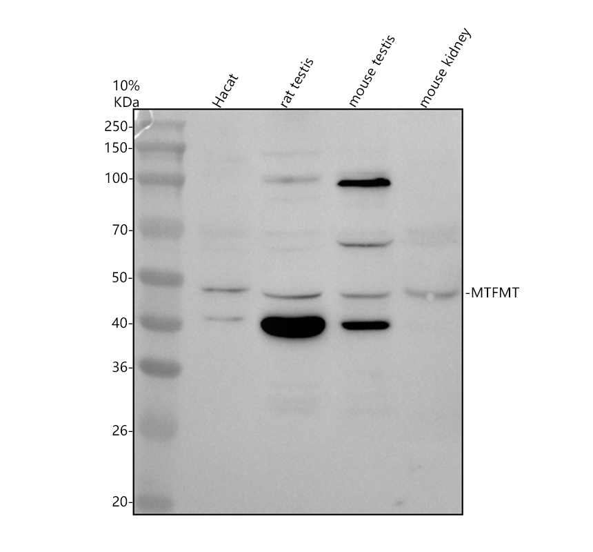 Western blot analysis of MTFMT using anti-MTFMT antibody (A11112-1)