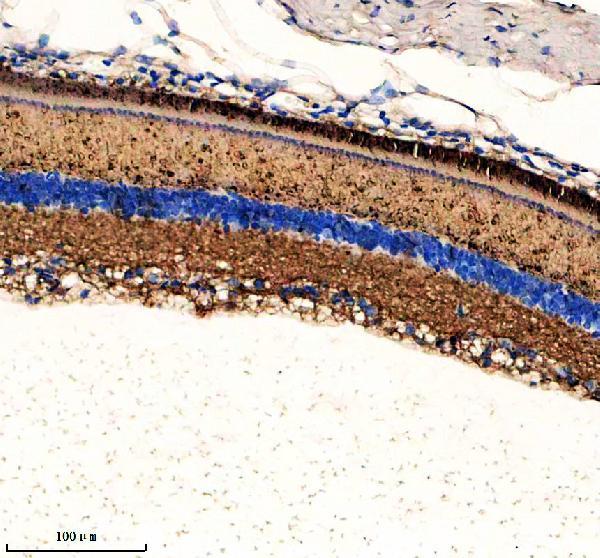 a11117 gngt1 primary antibodies ihc testing 1