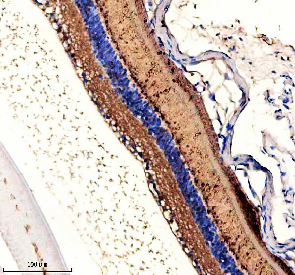 a11117 gngt1 primary antibodies ihc testing 2