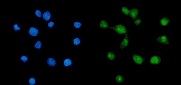 Figure 2. IF analysis of TAF8/TBN using anti-TAF8/TBN antibody (A11118-2). TAF8/TBN was detected in an immunocytochemical section of Caco-2 cells. Enzyme antigen retrieval was performed using IHC enzyme antigen retrieval reagent (AR0022) for 15 mins. The cells were blocked with 10% goat serum. And then incubated with 5 microg/mL rabbit anti-TAF8/TBN Antibody (A11118-2) overnight at 4°C. DyLight®488 Conjugated Goat Anti-Rabbit IgG (BA1127) was used as secondary antibody at 1:100 dilution and incubated for 30 minutes at 37°C. The section was counterstained with DAPI. Visualize using a fluorescence microscope and filter sets appropriate for the label used. Figure 2. IF analysis of TAF8/TBN using anti-TAF8/TBN antibody (A11118-2). TAF8/TBN was detected in an immunocytochemical section of Caco-2 cells. Enzyme antigen retrieval was performed using IHC enzyme antigen retrieval reagent (AR0022) for 15 mins. The cells were blocked with 10% goat serum. And then incubated with 5 microg/mL rabbit anti-TAF8/TBN Antibody (A11118-2) overnight at 4°C. DyLight®488 Conjugated Goat Anti-Rabbit IgG (BA1127) was used as secondary antibody at 1:100 dilution and incubated for 30 minutes at 37°C. The section was counterstained with DAPI. Visualize using a fluorescence microscope and filter sets appropriate for the label used.