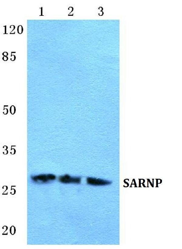 Western blot (WB) analysis of SARNP polyclonal antibody at 1:500 dilution
Lane1:Jurkat cell lysate
Lane2:Mouse heart tissue lysate
Lane3:Rat liver tissue lysate