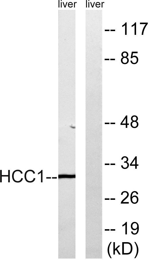 Western blot analysis of lysates from mouse liver, using HCC1 Antibody