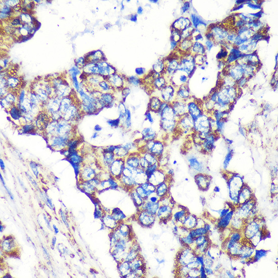 a11121 stard3nl primary antiboties ihc testing 2