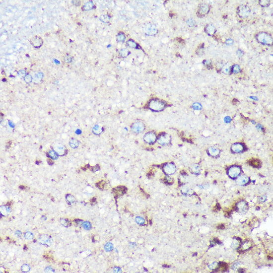 a11121 stard3nl primary antiboties ihc testing 3