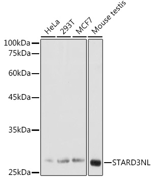 a11121 stard3nl primary antiboties wb testing 1