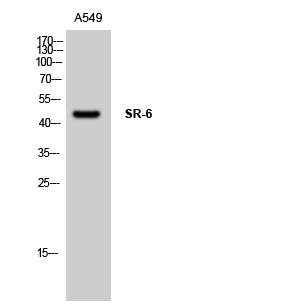 a11122 1 htr6 primary antibodies wb testing 1