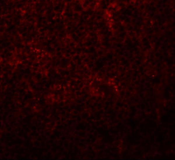 a11124 slc37a2 primary antibodies if testing 3