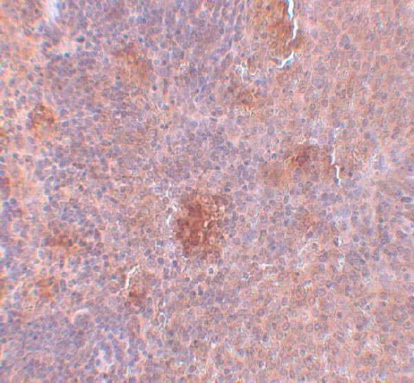 a11124 slc37a2 primary antibodies ihc testing 2